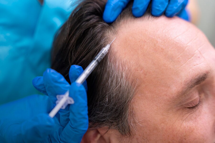 3 Session hair prp