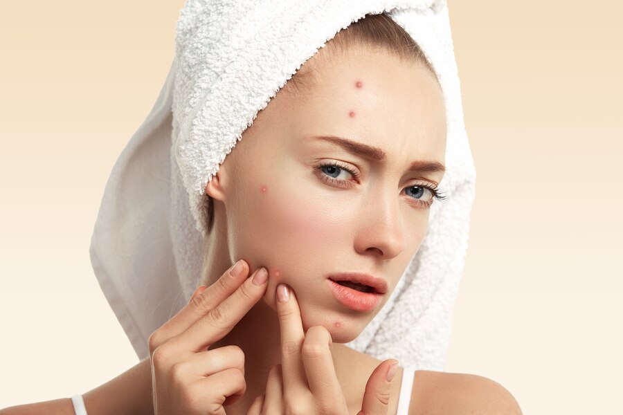 Acne LED Recovery Series