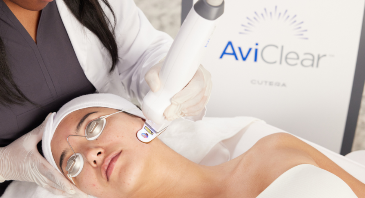 AviClear Laser Acne Treatment