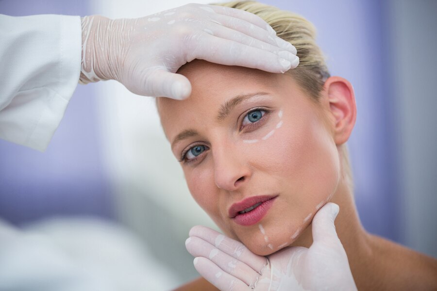 Acne Skin Care