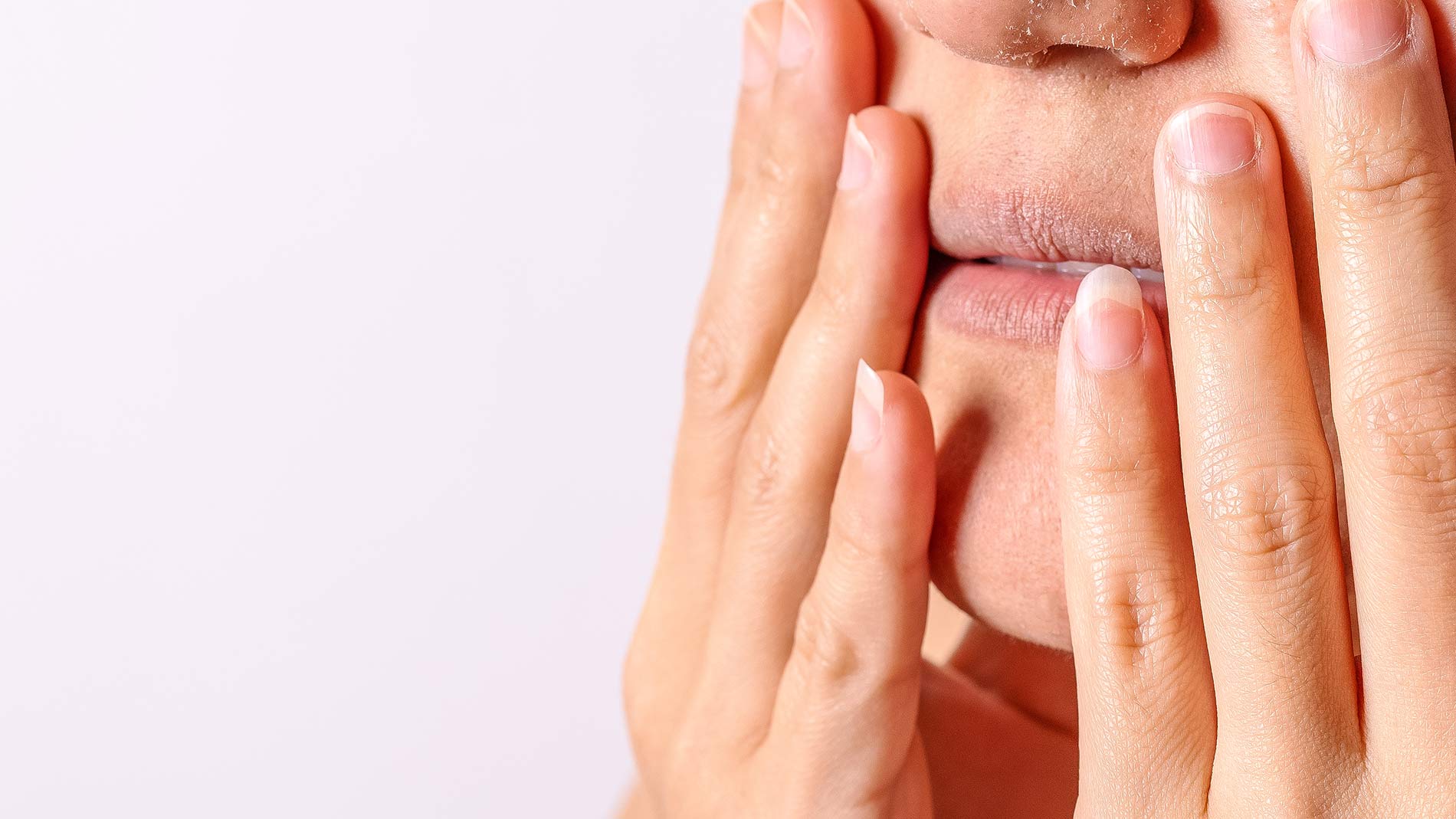 Perioral Dermatitis