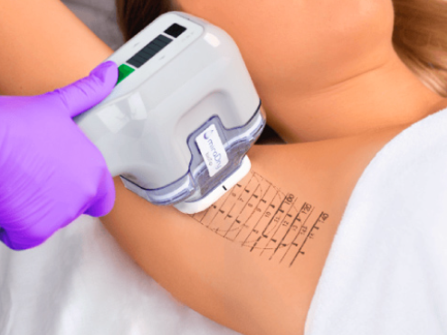 Surgical procedures