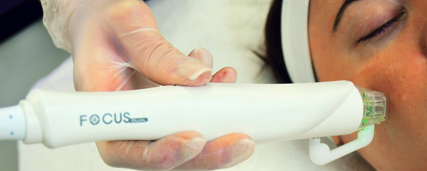 ELVE Fractional RF